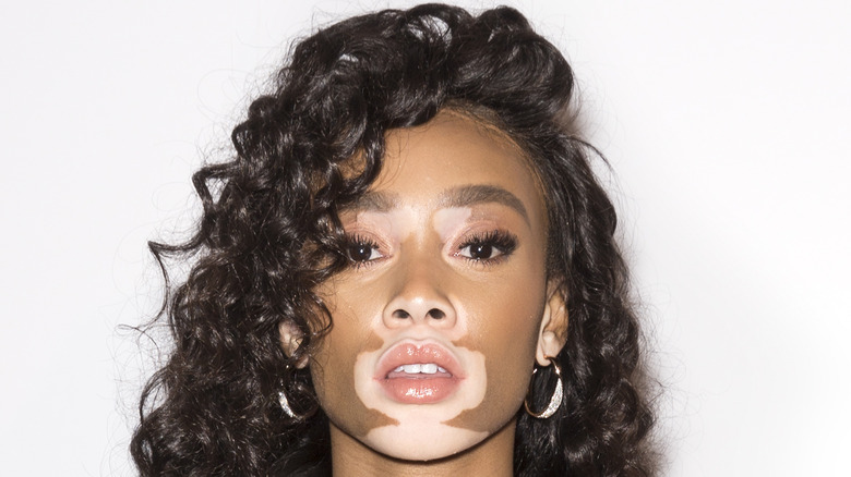 Winnie Harlow with lips parted