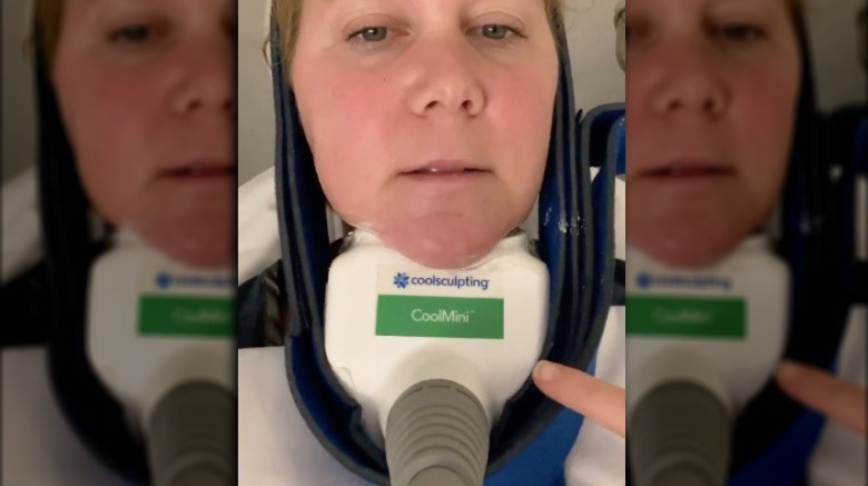 Amy Schumer in a Cool Sculpting device 