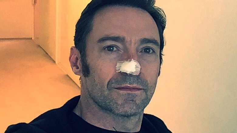 Hugh Jackman in a selfie with nose bandage 