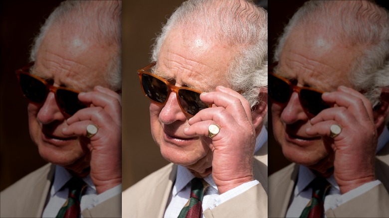 Prince Charles' swollen hand in 2021