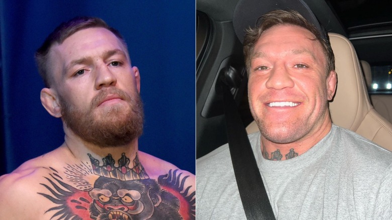 Conor McGregor with, without beard