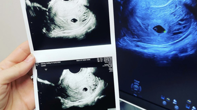 Ashley Spivey displaying ultrasound photos