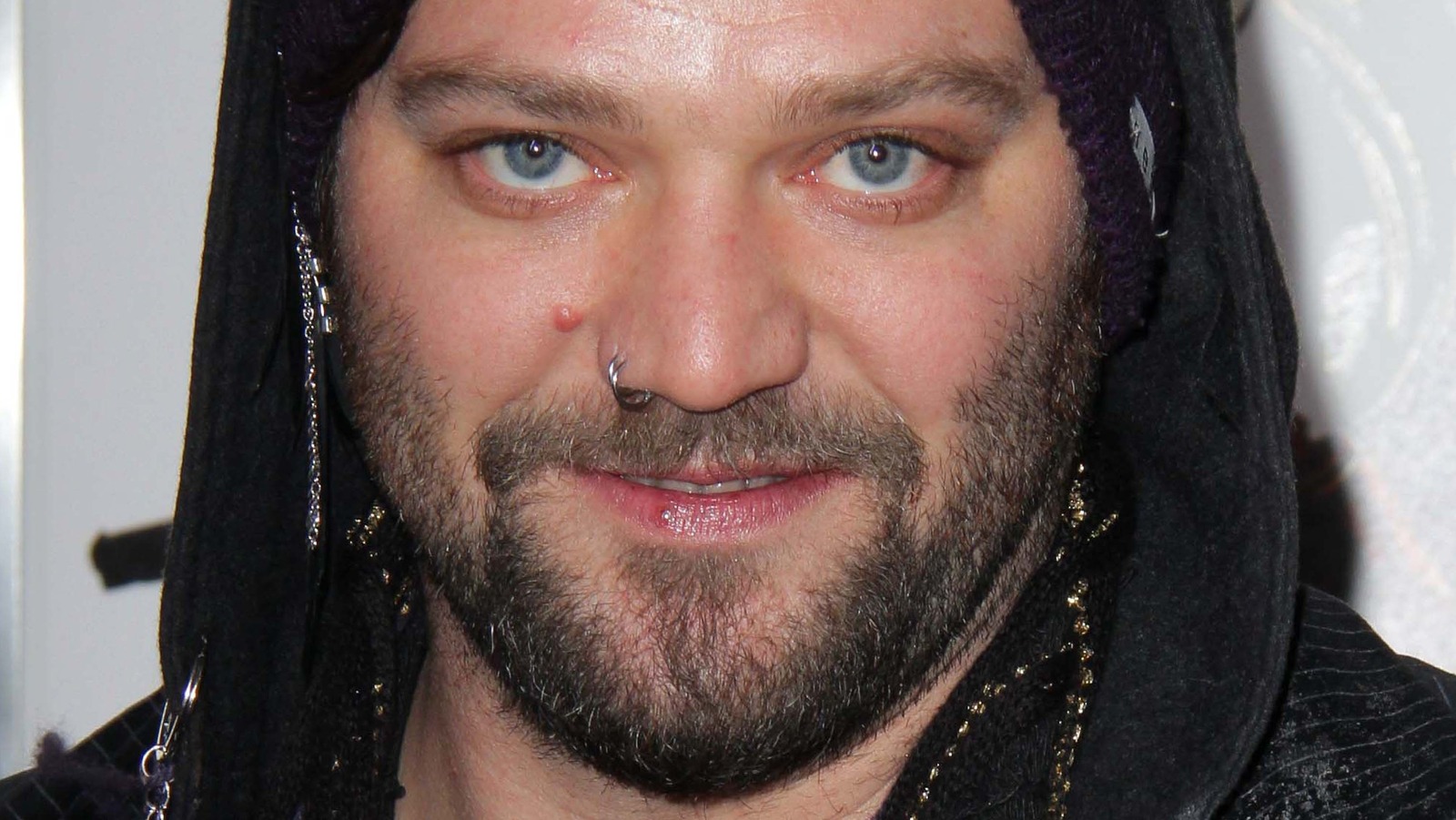 Bam Margera Now On The Mend After Grueling Bout Of Pneumonia