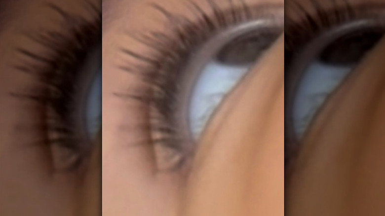 Cardi B's son's eye