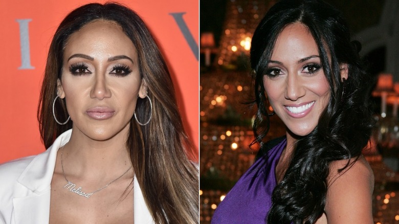 Melissa Gorga nose job before and after 