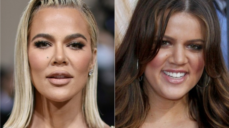 Khloe Kardashian nose job before and after