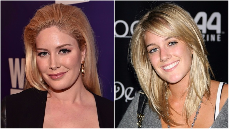 Heidi Montag nose job before and after 