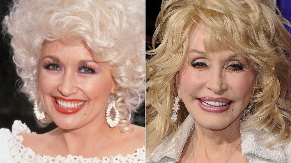 young Dolly Parton; present day Dolly Parton