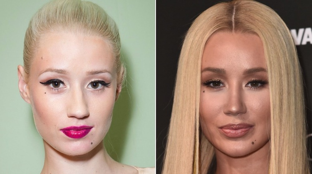 Iggy Azalea with hair pulled back; Iggy Azalea with straight hair