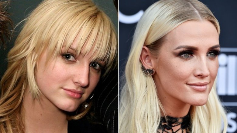 Before and after Ashlee Simpson's nose job