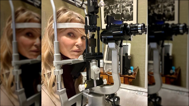 Christie Brinkley stares into the camera on a slit lamp