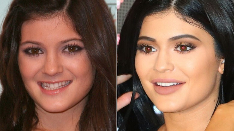 Younger & older Kylie Jenner smiling 