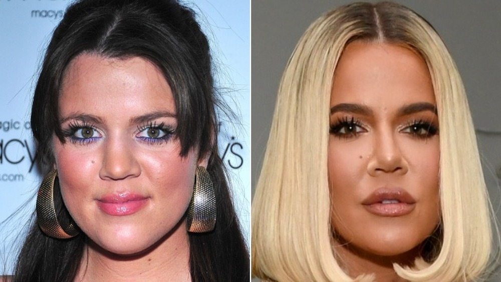 Khloe Kardashian before and after pics of possible cosmetic enhancements 