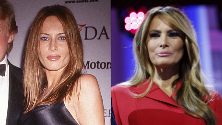 Melania Trump in 1999 and 2024