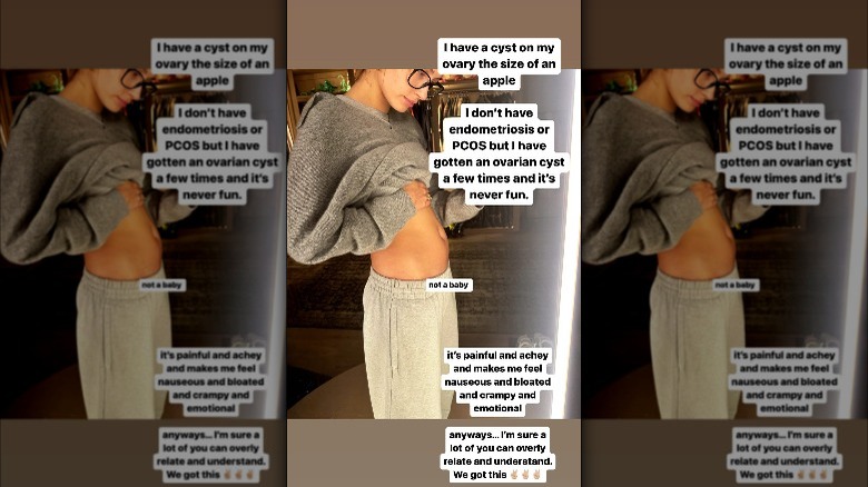 Hailey Bieber showing her stomach