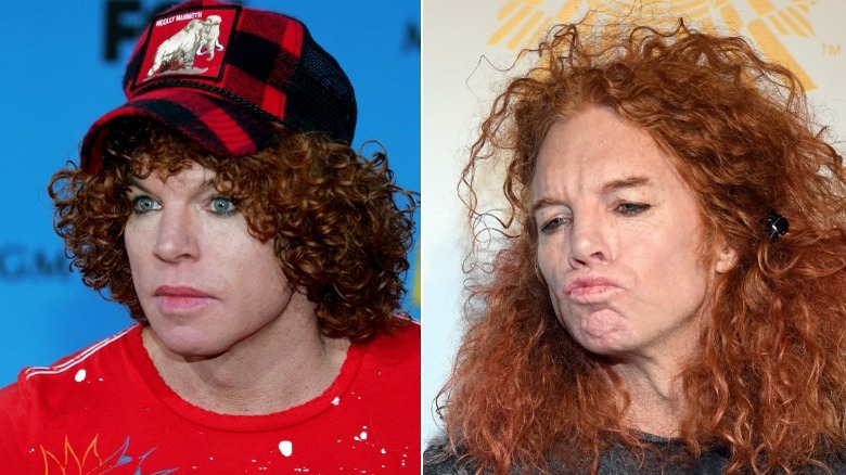 Has Carrot Top Had Plastic Surgery 