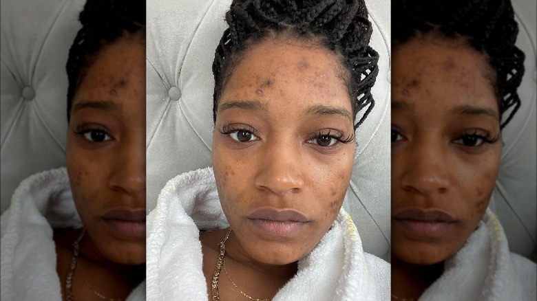 Keke Palmer without makeup