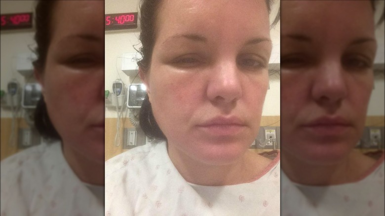 Pauley Perrette with swollen face