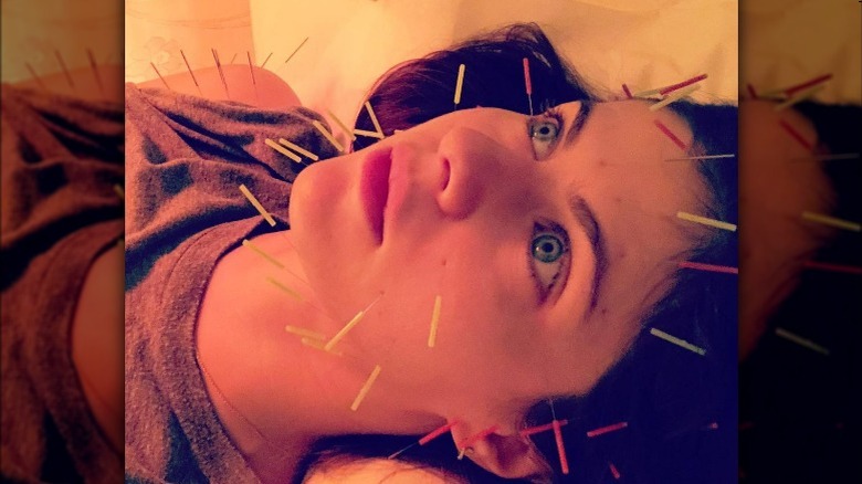 Alexandra Daddario acupuncture needles in face