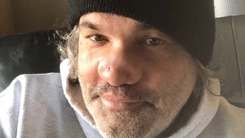 Artie Lange nose selfie