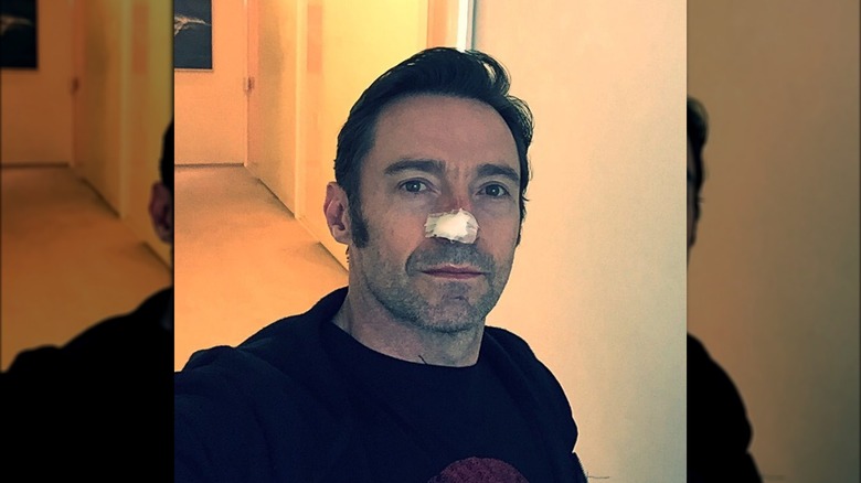 Hugh Jackman with a band-aid on his nose