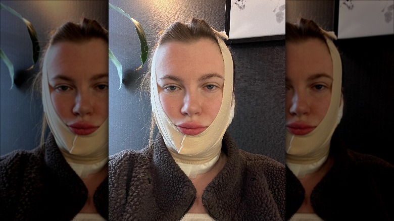 Ireland Baldwin with face bandaged