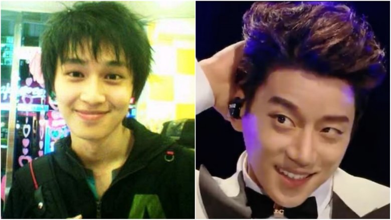 Hwang Chi Yeul before-and-after plastic surgery photos