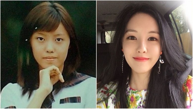 Hyomin from T-ARA before-and-after plastic surgery photos