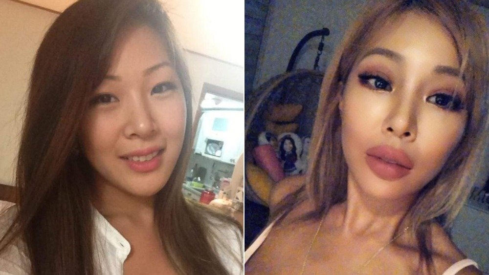 Jessi before-and-after plastic surgery photos