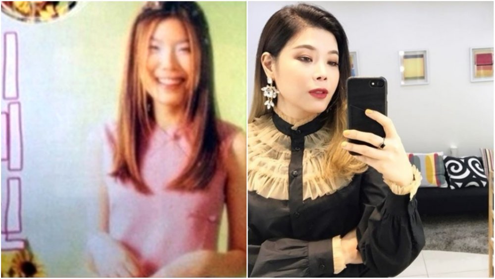 Lyn before-and-after plastic surgery photos