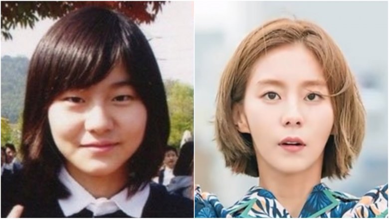 Uee from After School before-and-after plastic surgery photos