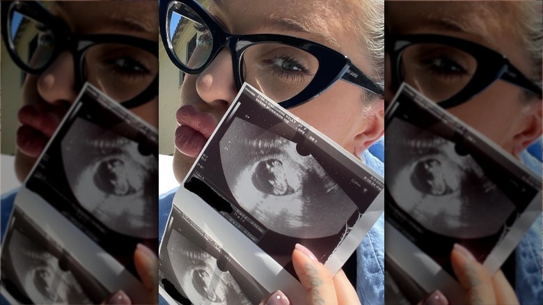 Kelly Osbourne with sonogram