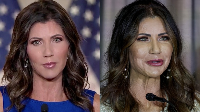 Kristi Noem Can't Escape The Rampant Plastic Surgery Rumors