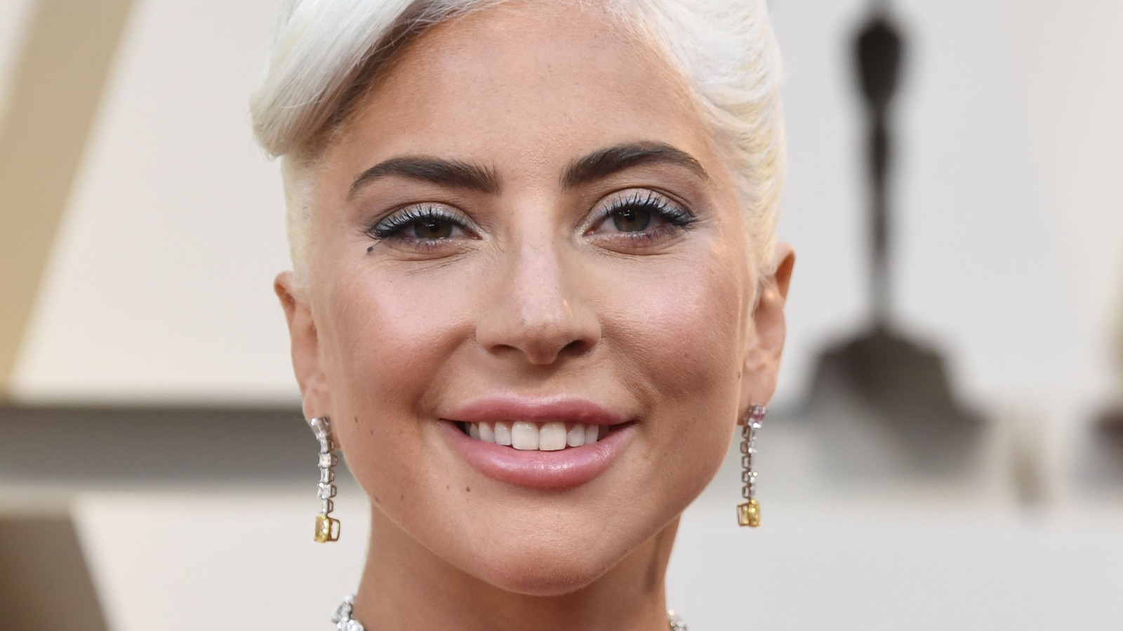 Lady Gaga's Dog Walker Shares Update On His Recovery