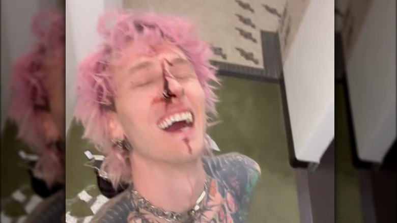 Machine Gun Kelly bloody nose