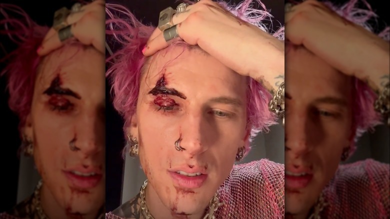 Machine Gun Kelly's bloody forehead