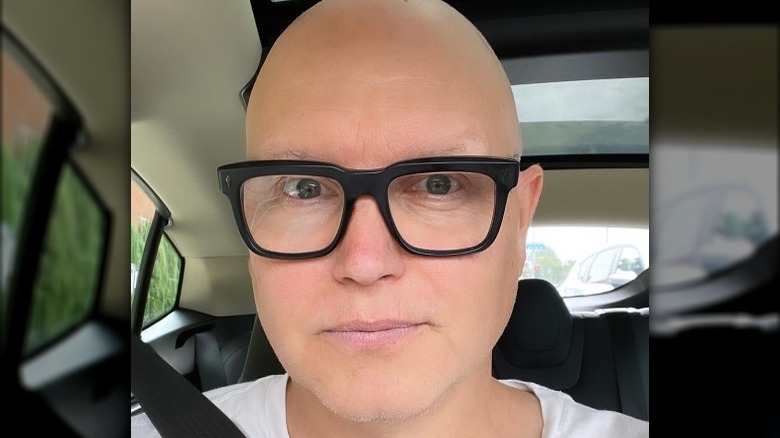 mark hoppus bald