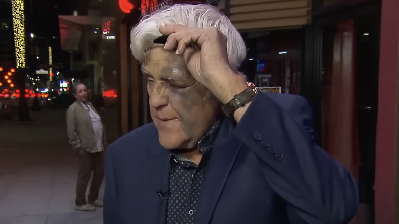 Jay Leno shows off black eye under eye patch to Inside Edition