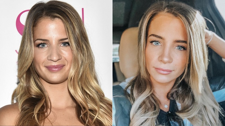 Naomie Olindo rhinoplasty before and after