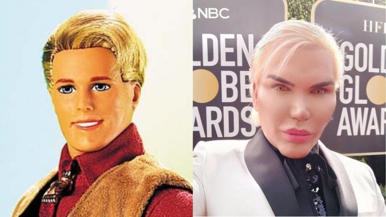 Ken doll, Rodrigo Alves