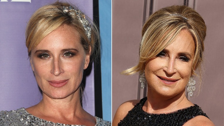 Sonja Morgan before and after plastic surgery