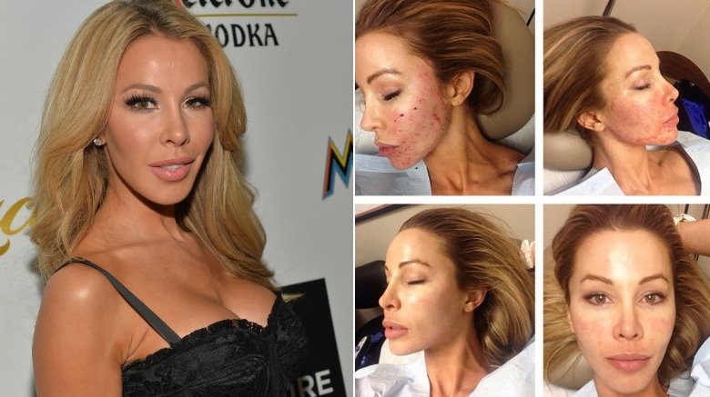 Lisa Hochstein