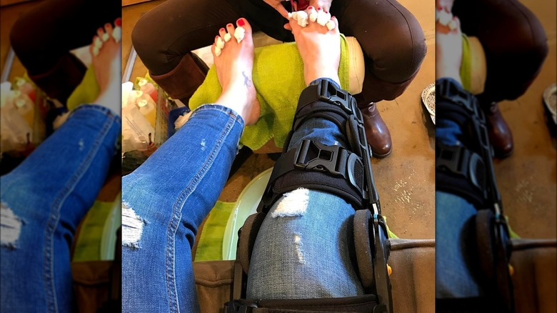 Alison Sweeney's leg in brace