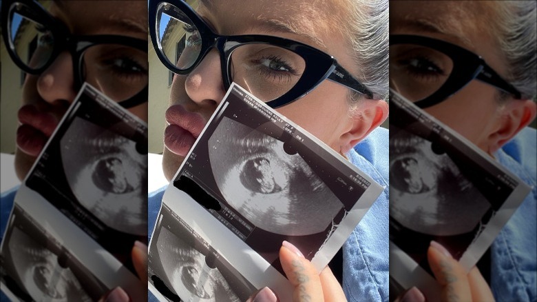 Kelly Osbourne holds ultrasound for selfie