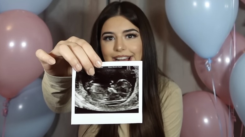 Sophia Grace Brownlee holding a picture of her sonogram