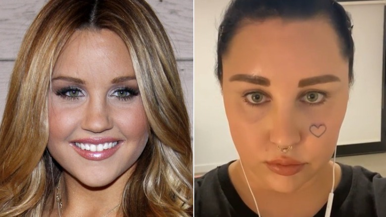 Amanda Bynes before and after 