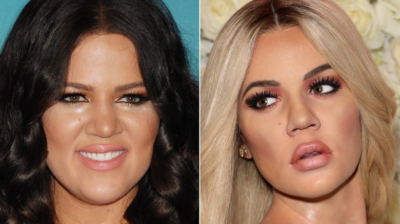 Khloe Kardashian before and after