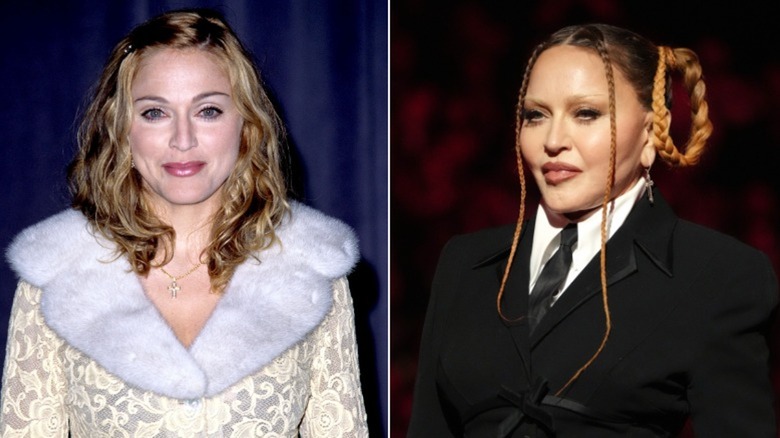 Madonna's face has become visibly fuller