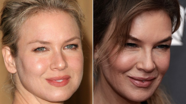 Renee Zellweger split image