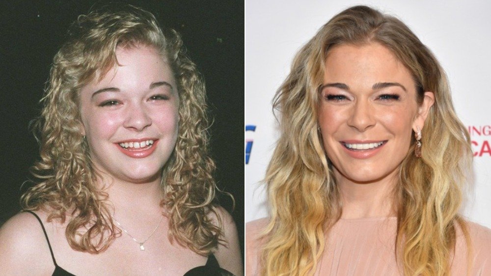 LeAnn Rimes before and after photos showing off her teeth